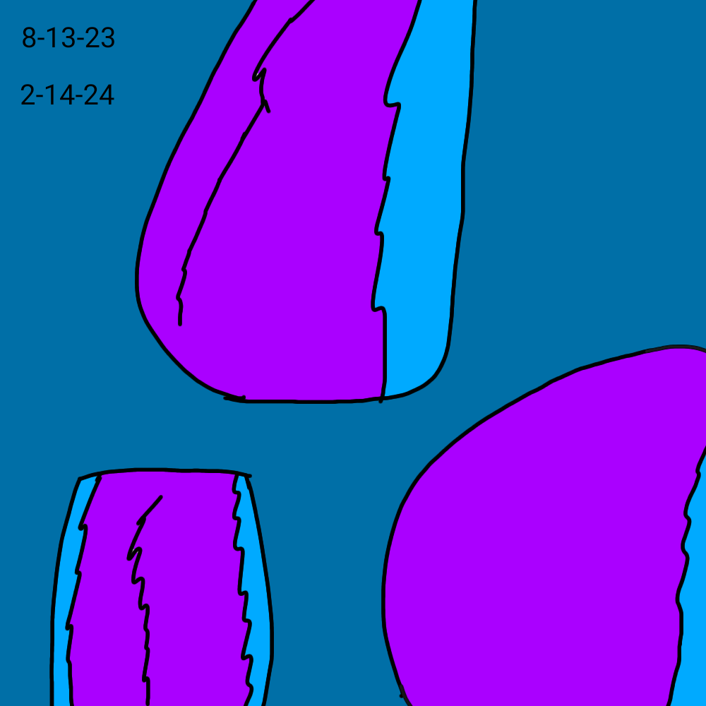 post 204268